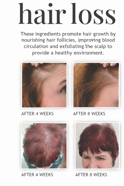 Growth & Shine Hair Serum – Advanced Scalp Support for Fuller, Healthier Hair