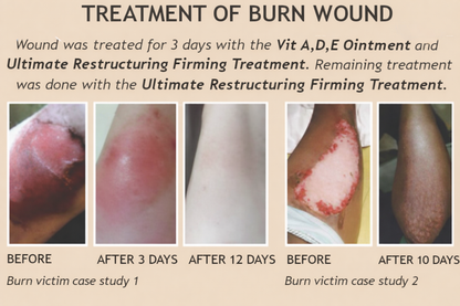 Ultimate Restructuring Firming Treatment – Wrinkle & Scar Repair Serum